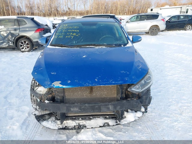 KMHD84LF3HU119162 Hyundai Elantra Se/value/limited
