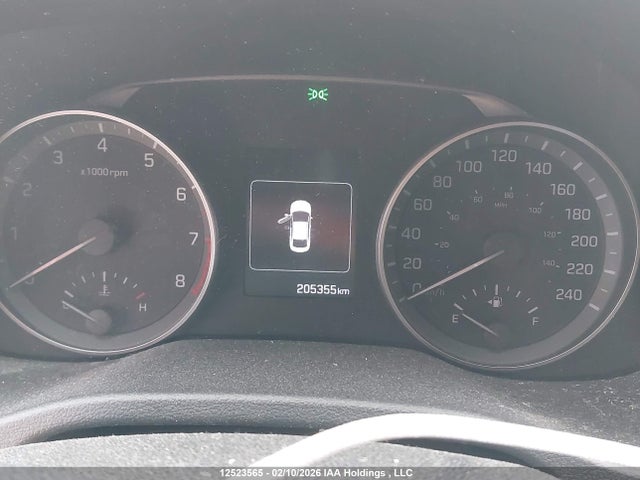 KMHD84LF3HU421308 Hyundai Elantra