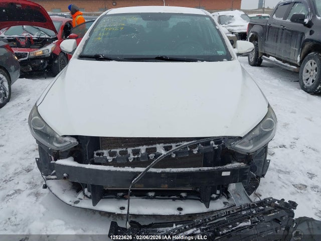 KMHD84LF6JU444569 Hyundai ELANTRA GL