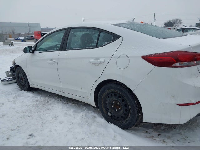 KMHD84LF6JU444569 Hyundai ELANTRA GL