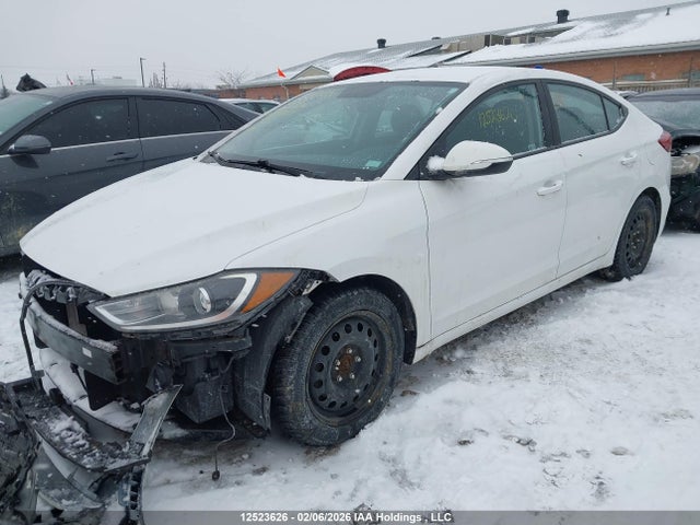KMHD84LF6JU444569 Hyundai ELANTRA GL