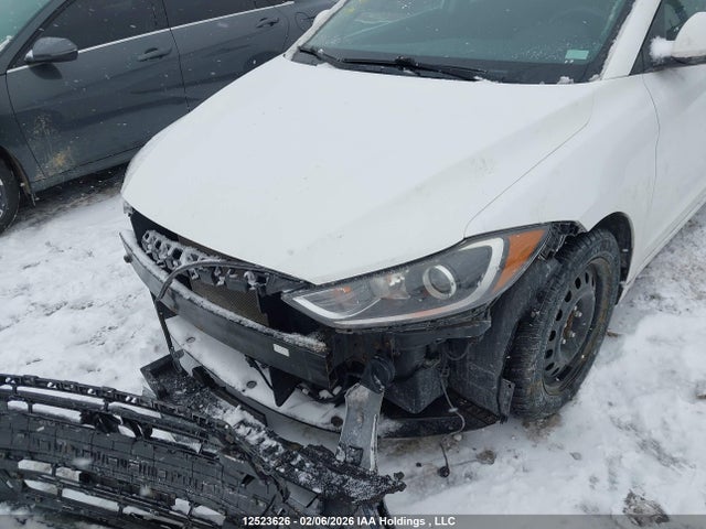 KMHD84LF6JU444569 Hyundai ELANTRA GL