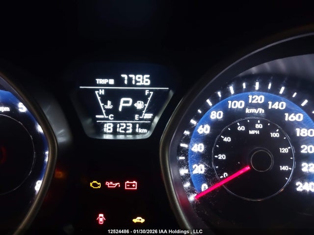 Продаж на аукціоні авто 2016 Hyundai Elantra Gl, vin: 5NPDH4AE7GH659363, номер лоту: 12524486