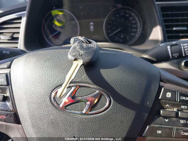 KMHD84LF5JU584824 Hyundai Elantra Sel/value/limited
