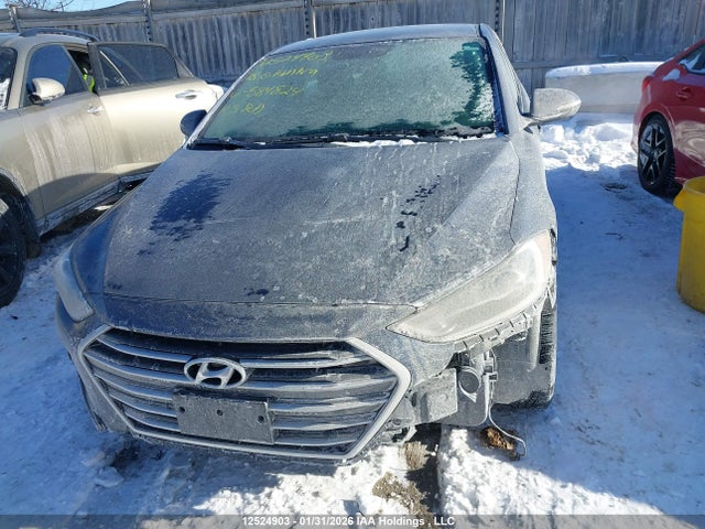 KMHD84LF5JU584824 Hyundai Elantra Sel/value/limited
