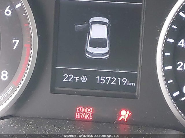 KMHD84LF4LU071227 Hyundai Elantra Sel/value/limited