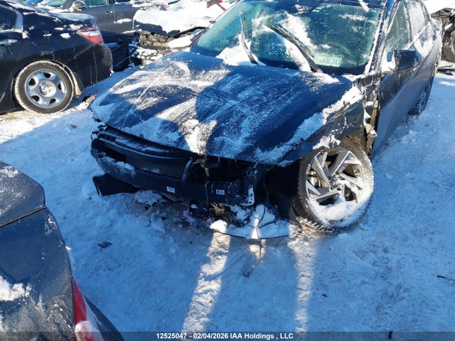 12525047 :رقم المزاد ، KMHLM4DG7SU864020 vin ، 2025 Hyundai Elantra Preferred With Tech Package مزاد بيع