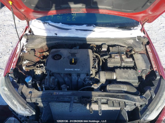 KMHD84LF2HU093881 Hyundai ELANTRA GL