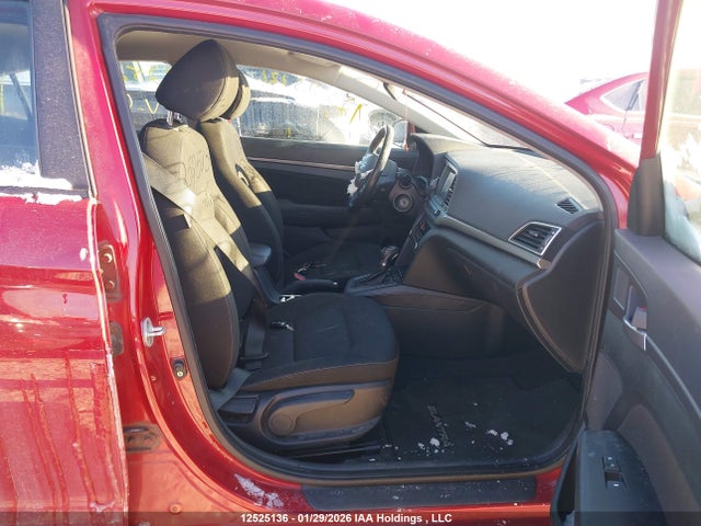 KMHD84LF2HU093881 Hyundai ELANTRA GL
