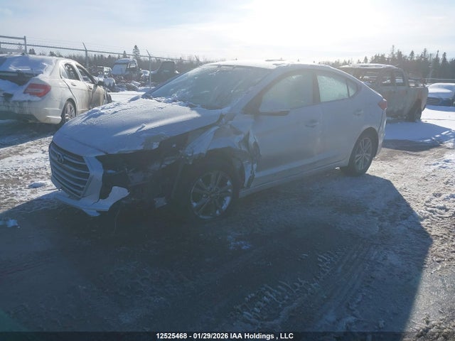 KMHD84LFXJU633015 Hyundai ELANTRA GL