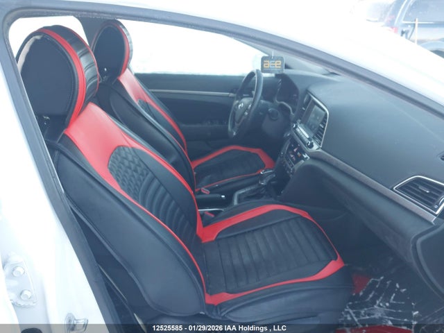 KMHD84LFXHU089142 Hyundai Elantra Gls