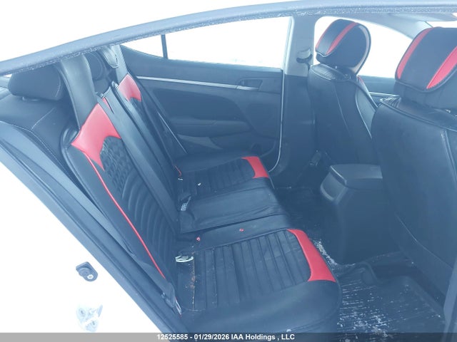 KMHD84LFXHU089142 Hyundai Elantra Gls