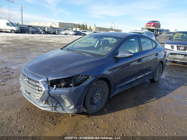 KMHD84LF1JU579877 Hyundai Elantra Gls