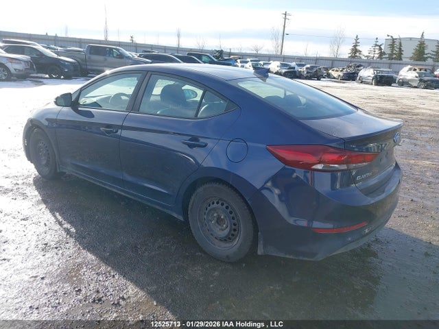 KMHD84LF1JU579877 Hyundai Elantra Gls