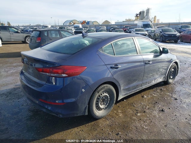KMHD84LF1JU579877 Hyundai Elantra Gls