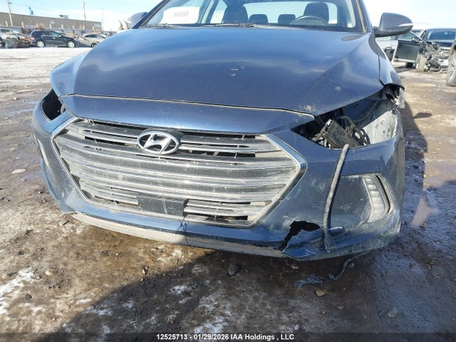 KMHD84LF1JU579877 Hyundai Elantra Gls