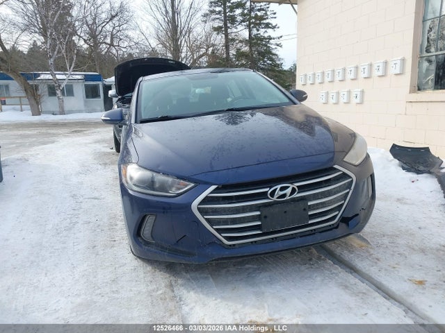 KMHD84LF0JU635520 Hyundai Elantra