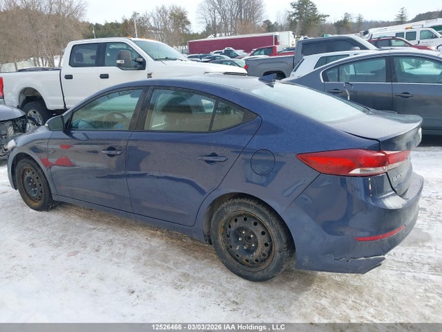 KMHD84LF0JU635520 Hyundai Elantra