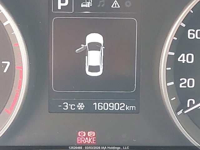 KMHD84LF0JU635520 Hyundai Elantra