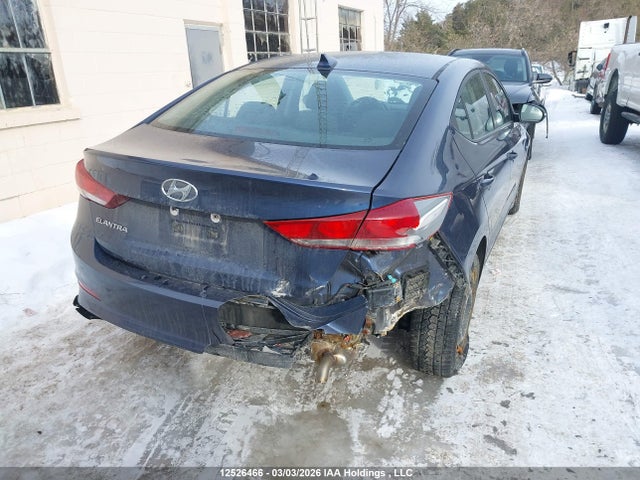 KMHD84LF0JU635520 Hyundai Elantra