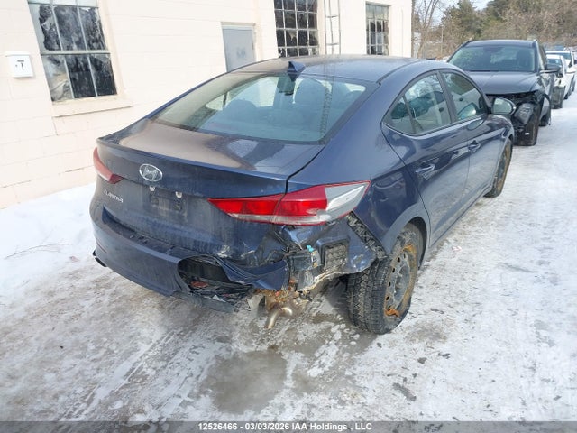 KMHD84LF0JU635520 Hyundai Elantra