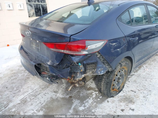 KMHD84LF0JU635520 Hyundai Elantra