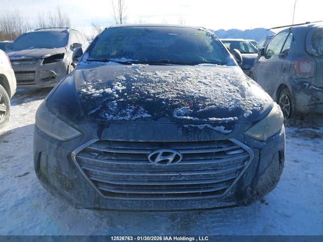 KMHD84LF2HU104734 Hyundai Elantra Se/value/limited
