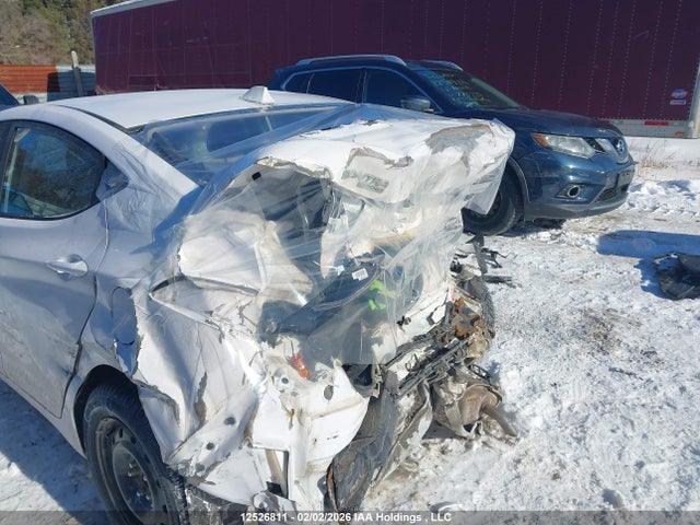 KMHDH4AE1GU571863 Hyundai Elantra Sport Appearance