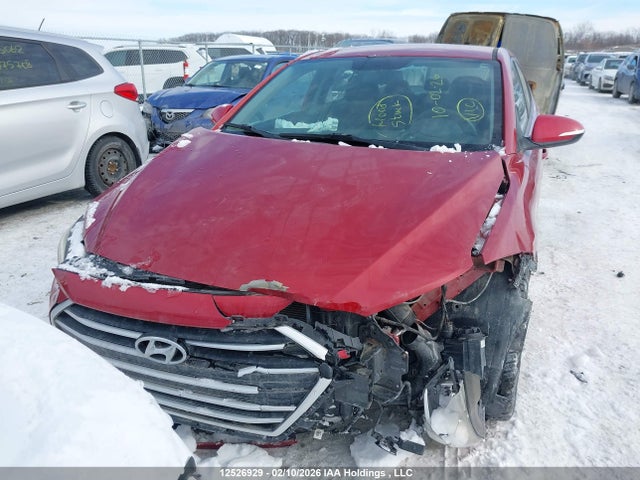 KMHD84LF1JU636742 Hyundai ELANTRA GL