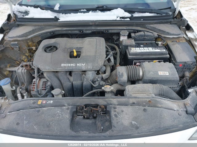 KMHD84LF6HU324815 Hyundai ELANTRA GL