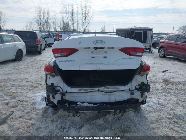 KMHD84LF6HU324815 Hyundai ELANTRA GL