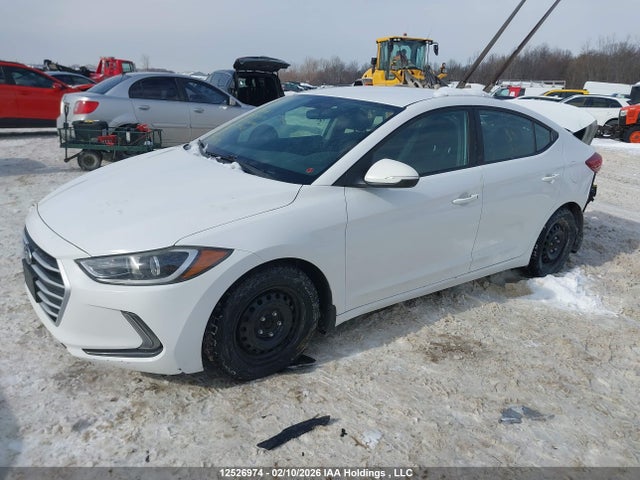 KMHD84LF6HU324815 Hyundai ELANTRA GL