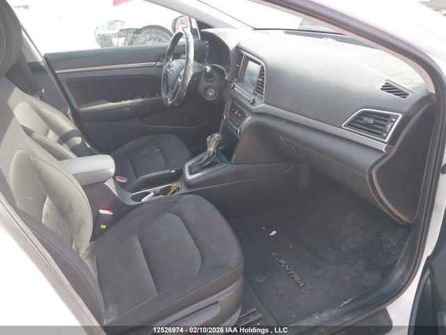KMHD84LF6HU324815 Hyundai ELANTRA GL