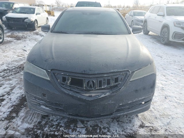 Acura TLX TECH 2015 19UUB3F51FA802335 Image 12