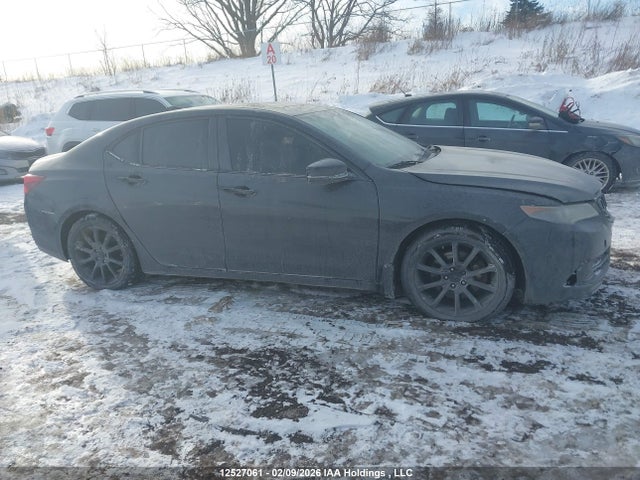 Acura TLX TECH 2015 19UUB3F51FA802335 Image 13