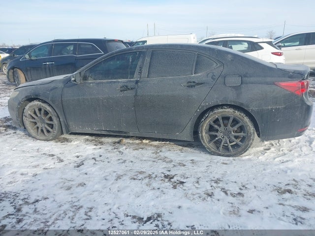 Acura TLX TECH 2015 19UUB3F51FA802335 Image 14