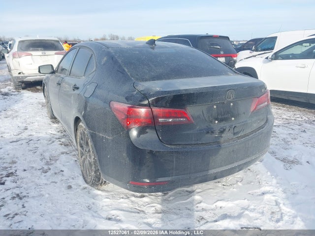Acura TLX TECH 2015 19UUB3F51FA802335 Image 3