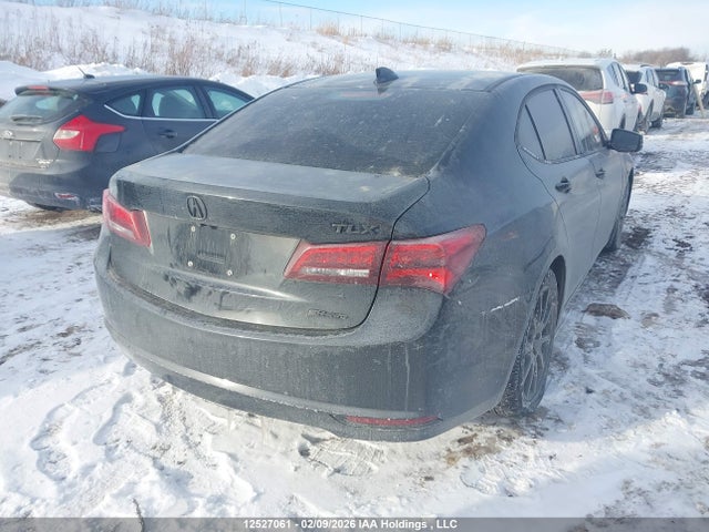 Acura TLX TECH 2015 19UUB3F51FA802335 Image 4