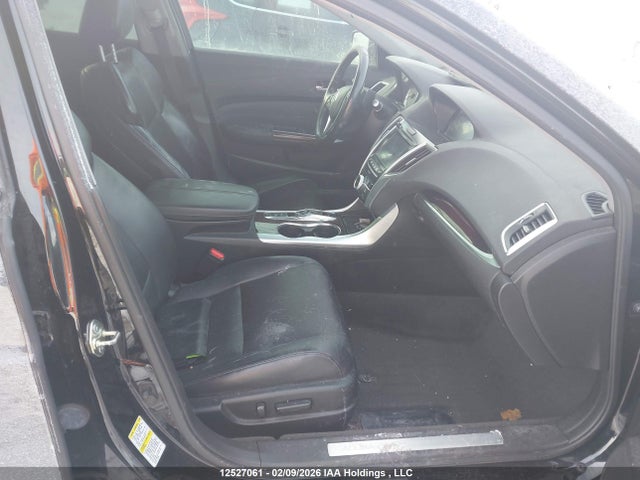 Acura TLX TECH 2015 19UUB3F51FA802335 Image 5