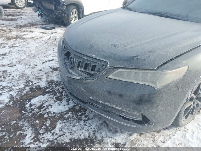 Acura TLX TECH 2015 19UUB3F51FA802335 Image 6