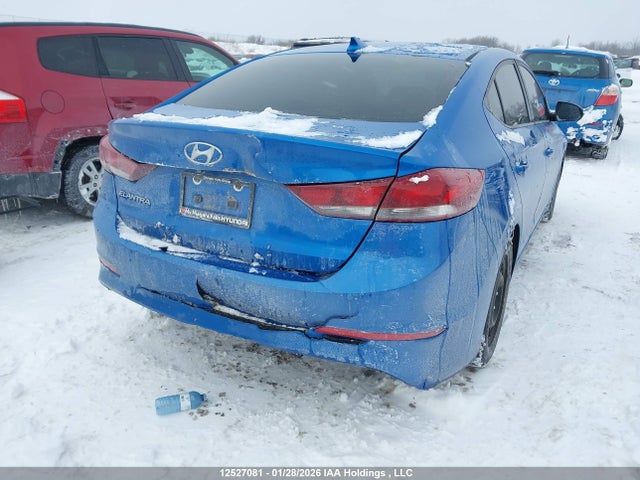 KMHD84LF1JU480475 Hyundai Elantra Sel/value/limited