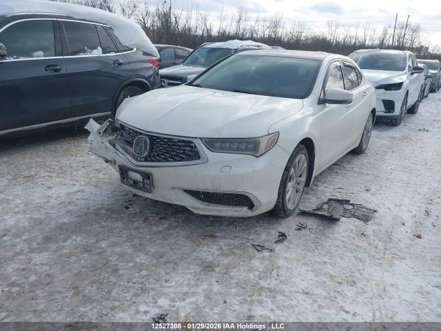 19UUB3F5XJA801175 Acura TLX