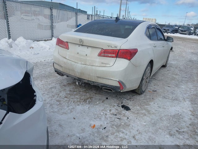 19UUB3F5XJA801175 Acura TLX