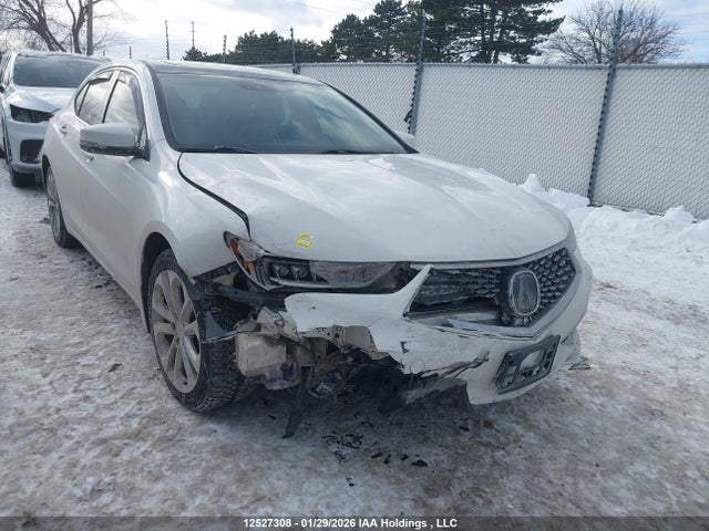 19UUB3F5XJA801175 Acura TLX