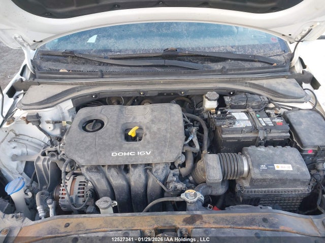 KMHD84LF2HU085294 Hyundai Elantra Se/value/limited
