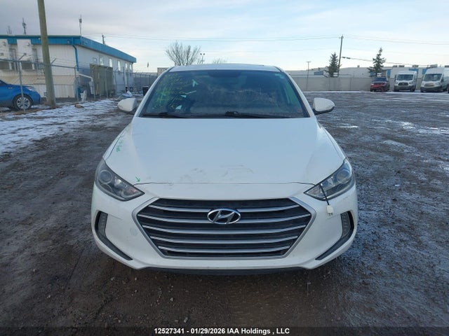 KMHD84LF2HU085294 Hyundai Elantra Se/value/limited