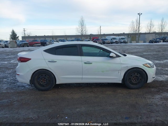 KMHD84LF2HU085294 Hyundai Elantra Se/value/limited