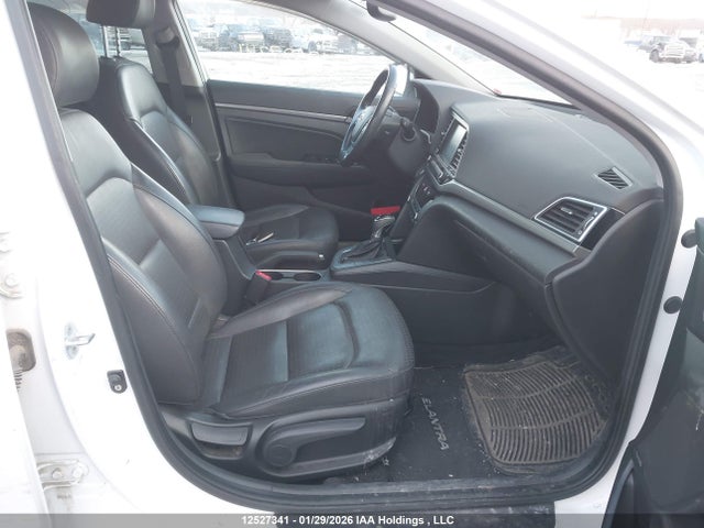 KMHD84LF2HU085294 Hyundai Elantra Se/value/limited