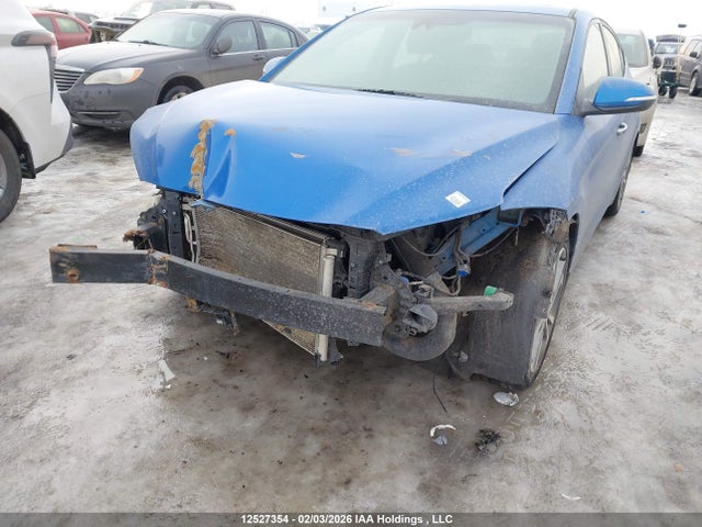 KMHD84LF1HU125137 Hyundai Elantra Limited Ultimate