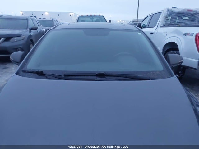 KMHD84LF2JU499200 Hyundai Elantra Gl Se
